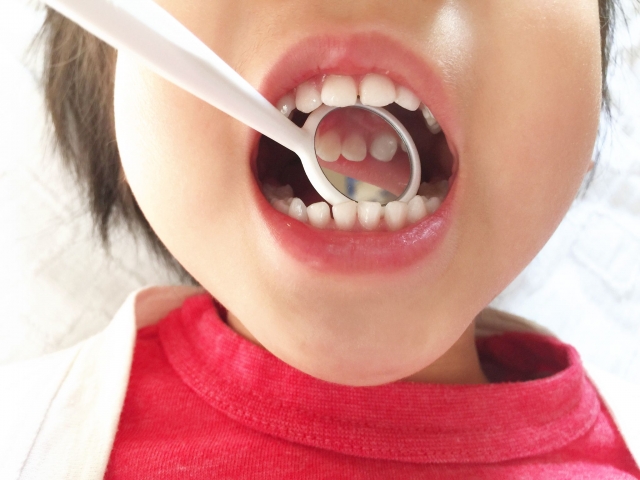 子どもの歯並びって
いつから治療を
始めればいいの？
