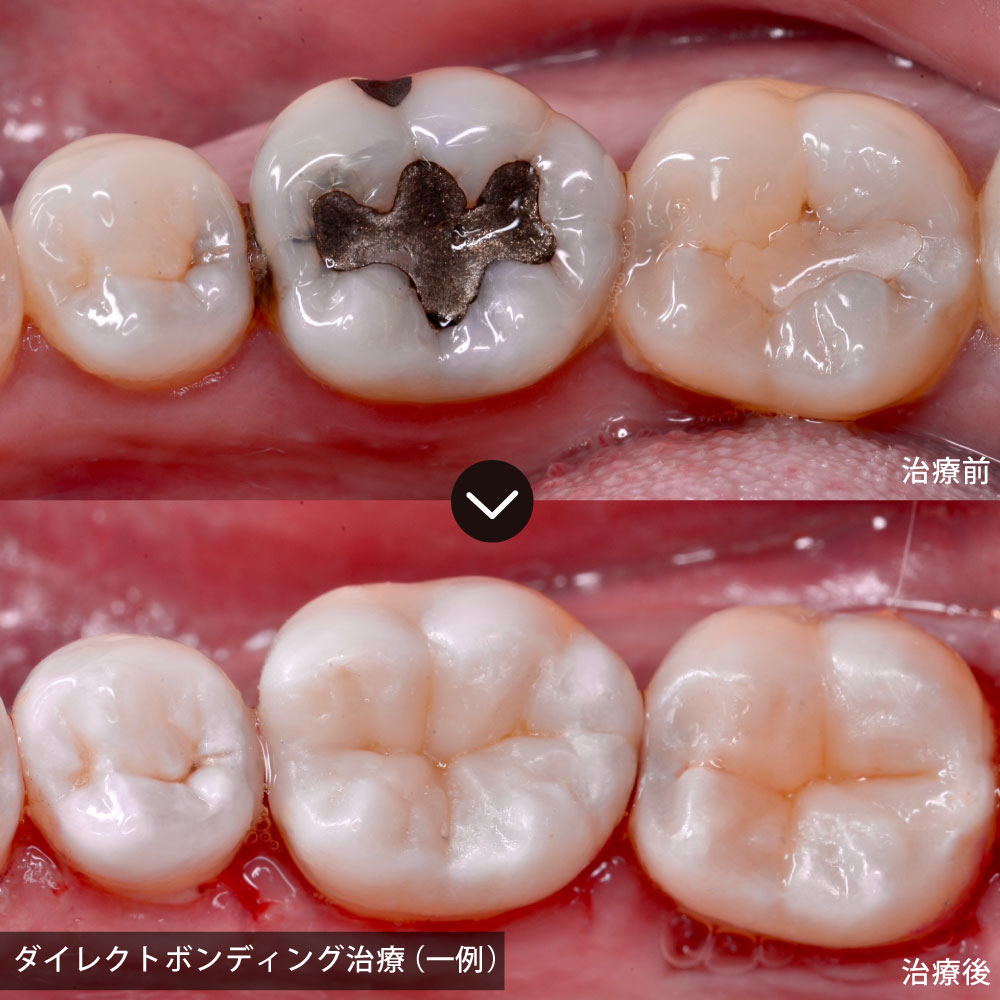 できる限り、ご自身の歯を残す治療を大切にしています