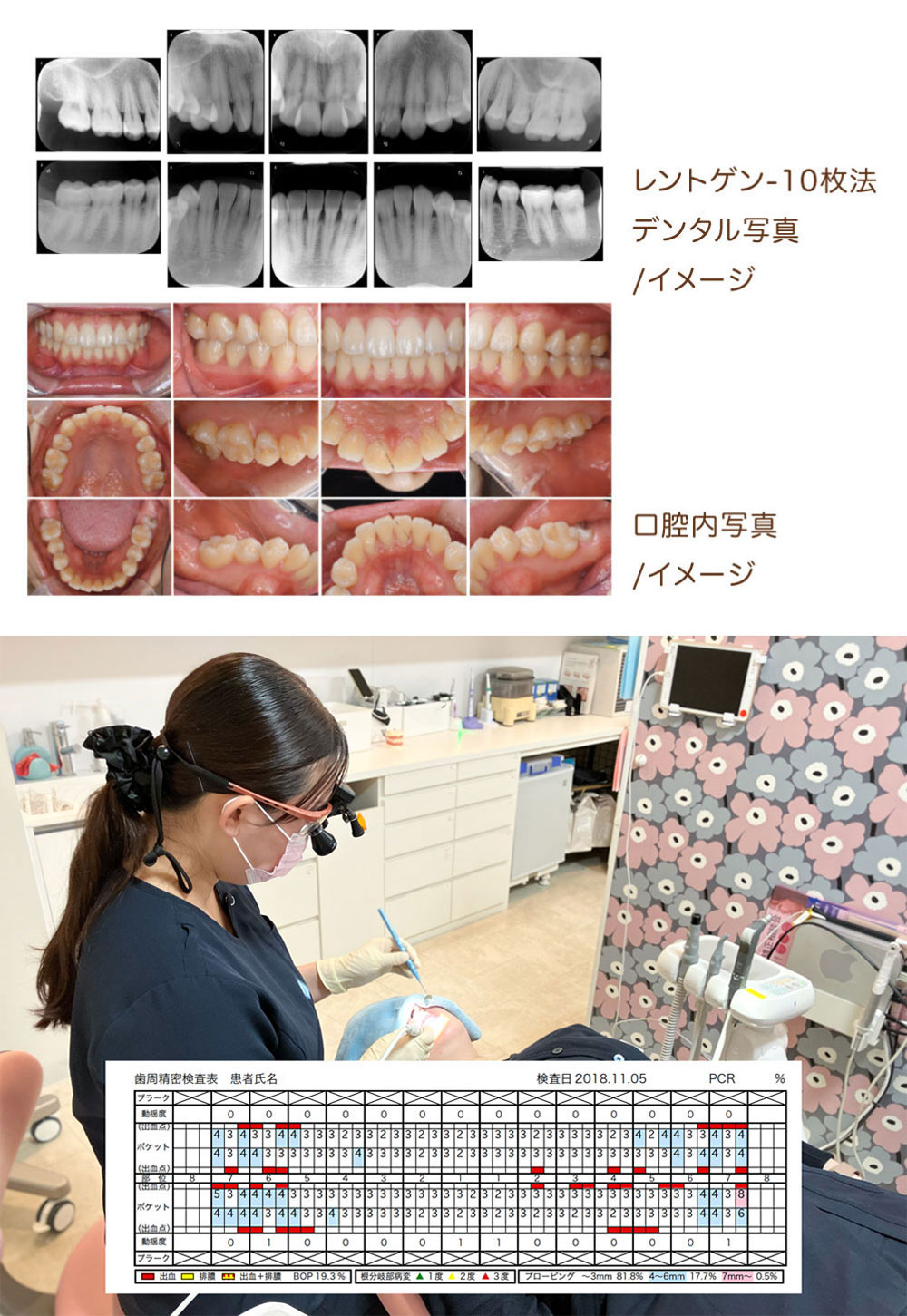 口腔内をしっかり検査